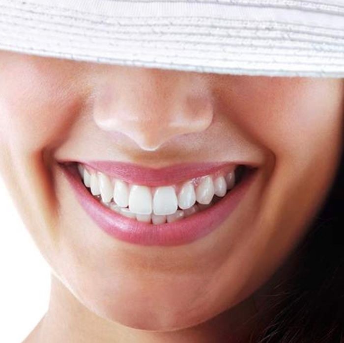 Bright White 30 minutes Teeth Whitening Treatment $95